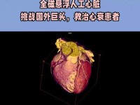 《拯救心脏病人游戏攻略》（通过游戏挽救心脏病患者生命，提高医疗技能！）